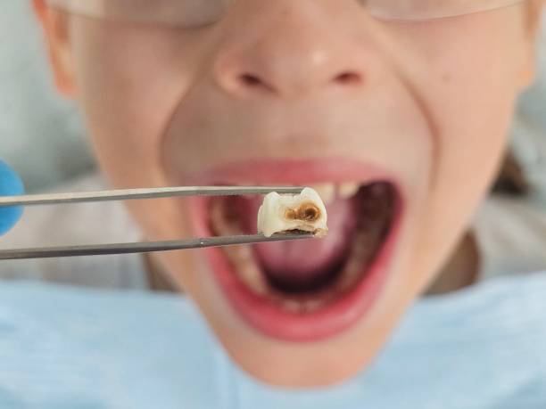 Best Emergency Tooth Extraction in Conway, PA